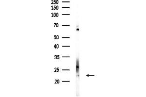 anti-Copper Metabolism (Murr1) Domain Containing 1 (COMMD1) (Internal Region) antibody