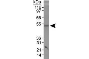 Western blot analysis of PLIN3 in 3T3-L1 lysate using PLIN3 polyclonal antibody . (PLIN3 抗体  (AA 350-435))