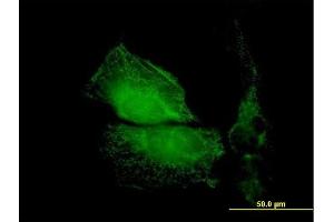Immunofluorescence of purified MaxPab antibody to TMOD1 on HeLa cell. (Tropomodulin 1 抗体  (AA 1-359))