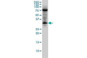 EDA2R monoclonal antibody (M02), clone 3C1. (Ectodysplasin A2 Receptor 抗体  (AA 1-110))