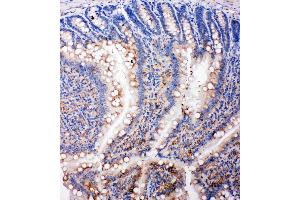 Anti-SMAD5 antibody, IHC(P) IHC(P): Rat Intestine Tissue (SMAD5 抗体  (Middle Region))