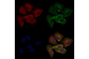 ABIN6265691 and ABIN6276606 staining Hela cells by IF/ICC.