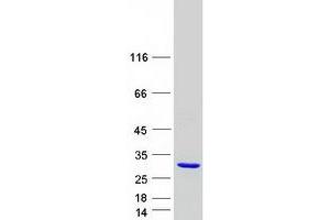 Validation with Western Blot (DPCD Protein (Myc-DYKDDDDK Tag))