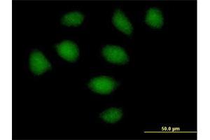 Immunofluorescence of purified MaxPab antibody to SECISBP2 on HeLa cell. (SECISBP2 抗体  (AA 1-854))