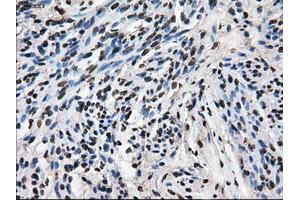 Immunohistochemical staining of paraffin-embedded Ovary tissue using anti-LEMD3mouse monoclonal antibody. (LEMD3 抗体)