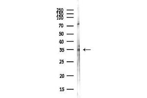 Western blot analysis of lysates from COLO205 cells(heat-shock,45 min treatment), using Connexin 36/GJ Antibody at 1/1000 dilution.