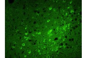 Formalin-fixed and paraffin embedded rat brain labeled with Rabbit Anti-Calreticulin Polyclonal Antibody, FITC Conjugated  at 1:100 for 40 minutes at 37°C. (Calreticulin 抗体  (AA 101-200) (FITC))