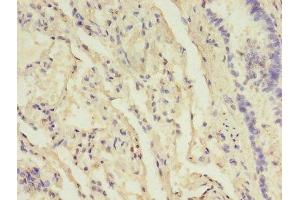 Immunohistochemistry of paraffin-embedded human lung tissue using ABIN7157832 at dilution of 1:100 (B3GNT5 抗体  (AA 65-344))