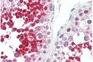 Human Testis: Formalin-Fixed, Paraffin-Embedded (FFPE) (ROPN1L 抗体  (C-Term))