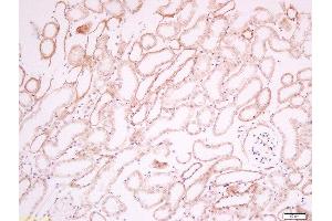 Paraformaldehyde-fixed, paraffin embedded mouse kidney tissue, Antigen retrieval by boiling in sodium citrate buffer(pH6) for 15min, Block endogenous peroxidase by 3% hydrogen peroxide for 30 minutes, Blocking buffer (normal goat serum) at 37°C for 20min, Antibody incubation with Rabbit Anti-CD34 Polyclonal Antibody, Unconjugated  at 1:200 overnight at 4°C, followed by a conjugated secondary and DAB staining (CD34 抗体  (AA 210-260))