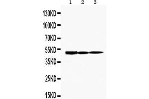 Western blot analysis of KIM1 using anti-KIM1 antibody . (HAVCR1 抗体  (C-Term))