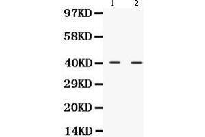 Western Blotting (WB) image for anti-NDRG Family Member 2 (NDRG2) (AA 210-247), (C-Term) antibody (ABIN3043261) (NDRG2 抗体  (C-Term))
