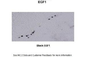 Sample Type :  Frog brain  Primary Antibody Dilution :  1:500  Secondary Antibody :  Biotinylated goat anti-rabbit  Secondary Antibody Dilution :  1:200  Color/Signal Descriptions :  Black: EGF1  Gene Name :  EGR1 a  Submitted by :  Eva Fischer, Colorado State University (EGR1 抗体  (N-Term))