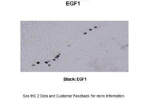 Sample Type :  Frog brain  Primary Antibody Dilution :  1:500  Secondary Antibody :  Biotinylated goat anti-rabbit  Secondary Antibody Dilution :  1:200  Color/Signal Descriptions :  Black: EGF1  Gene Name :  EGR1 a  Submitted by :  Eva Fischer, Colorado State University