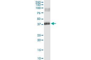 Immunoprecipitation of HSD17B2 transfected lysate using anti-HSD17B2 MaxPab rabbit polyclonal antibody and Protein A Magnetic Bead , and immunoblotted with HSD17B2 purified MaxPab mouse polyclonal antibody (B02P) . (HSD17B2 抗体  (AA 1-387))