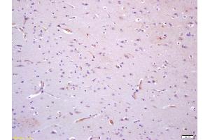 Formalin-fixed and paraffin embedded human brain with labeled Anti-TIE1 Polyclonal Antibody, Unconjugated (ABIN675099) at 1:200, followed by conjugation to the secondary antibody and DAB staining (TIE1 抗体  (AA 851-1000))