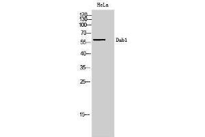 Western Blotting (WB) image for anti-Disabled Homolog 1 (Drosophila) (DAB1) (Ser295) antibody (ABIN3174701) (DAB1 抗体  (Ser295))