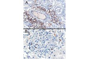 ABIN185183 (0. (SH3BP1 抗体  (C-Term))