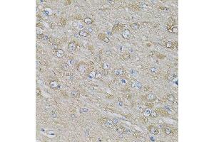 Immunohistochemistry of paraffin-embedded rat brain using EIF3H Antibody. (EIF3H 抗体  (AA 80-340))