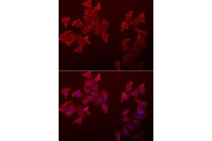 Immunofluorescence analysis of A549 cell using LECT1 antibody. (LECT1 抗体)