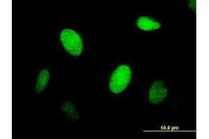 Immunofluorescence of purified MaxPab antibody to CENPJ on HeLa cell. (CENPJ 抗体  (AA 1-372))