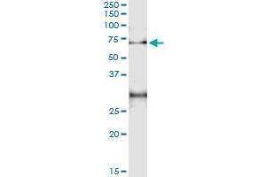 Immunoprecipitation of ACD transfected lysate using mouse monoclonal anti-ACD and Protein A Magnetic Bead (ACD (人) IP-WB Antibody Pair)