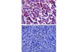 Immunohistochemistry analysis using Rabbit Anti-TLR4 Polyclonal Antibody . (TLR4 抗体  (AA 420-435) (FITC))