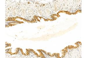 ABIN7094899 and ABIN7098952 at 1/100 staining Rat lung tissue by IHC-P. (ECSIT 抗体  (Internal Region))