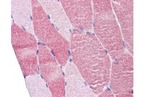 IHC-P Image Immunohistochemical analysis of paraffin-embedded human skeletal muscle , using DAP5, antibody(10 μg/ml). (EIF4G2 抗体  (N-Term))