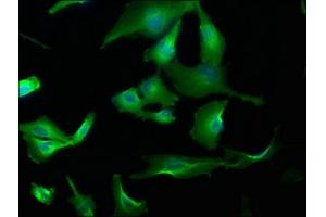 Immunofluorescence staining of U251 cells with ABIN7153709 at 1:173, counter-stained with DAPI. (WDR59 抗体  (AA 619-862))