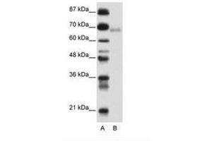 Image no. 1 for anti-Zinc Finger and BTB Domain Containing 22 (ZBTB22) (AA 421-470) antibody (ABIN6736152) (ZBTB22 抗体  (AA 421-470))