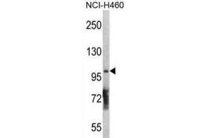 Western Blotting (WB) image for anti-Diacylglycerol Kinase, theta 110kDa (DGKQ) antibody (ABIN3003694) (DGKQ 抗体)