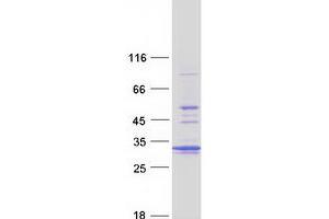 Western Blotting (WB) image for Proteasome Subunit alpha 5 (PSMA5) protein (Myc-DYKDDDDK Tag) (ABIN2729906)