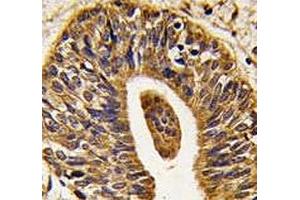 Immunohistochemistry (IHC) image for anti-Receptor tyrosine-protein kinase erbB-2 (ErbB2/Her2) (AA 1227-1255) antibody (ABIN3029510)