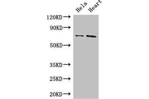 Western Blot Positive WB detected in: Hela whole cell lysate, Mouse heart tissue All lanes: PCK2 antibody at 3. (PEPCK 抗体  (AA 101-400))
