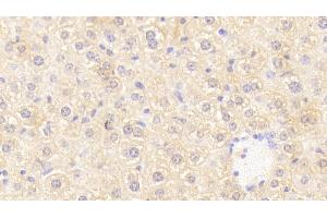 Detection of OSMR in Mouse Liver Tissue using Polyclonal Antibody to Oncostatin M Receptor (OSMR) (Oncostatin M Receptor 抗体  (AA 410-652))
