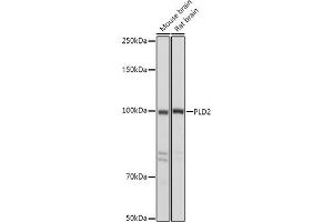 Western blot analysis of extracts of various cell lines, using PLD2 antibody (ABIN6129076, ABIN6145764, ABIN6145765 and ABIN6214347) at 1:500 dilution. (Phospholipase D2 抗体  (AA 1-180))