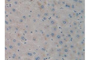 DAB staining on IHC-P; Samples: Human Liver Tissue (CXCL12 抗体  (AA 23-89))
