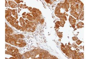 IHC-P Image Immunohistochemical analysis of paraffin-embedded human gastric, using TDP1, antibody at 1:100 dilution. (TDP1 抗体)