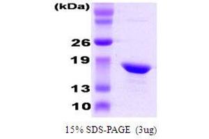 SDS-PAGE (SDS) image for Crystallin, alpha B (CRYAB) protein (ABIN666824) (CRYAB 蛋白)