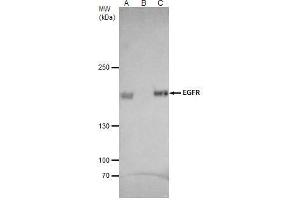 IP Image EGFR antibody [C2C3], C-term immunoprecipitates EGFR protein in IP experiments. (EGFR 抗体  (C-Term))