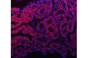 IF analysis of mSin3A/SIN3A using anti-mSin3A/SIN3A antibody (ABIN7602504). (SIN3A 抗体  (AA 8-918))