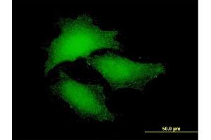 Immunofluorescence of purified MaxPab antibody to NF2 on HeLa cell. (Merlin 抗体  (AA 1-507))
