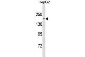 TTBK1 Antibody (Center) (ABIN1881954 and ABIN2838922) western blot analysis in HepG2 cell line lysates (35 μg/lane). (TTBK1 抗体  (AA 667-695))