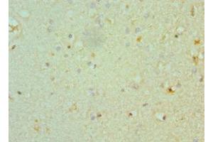 Immunohistochemistry of paraffin-embedded human brain tissue using ABIN7160351 at dilution of 1:100 (CHRM3 抗体  (AA 270-470))