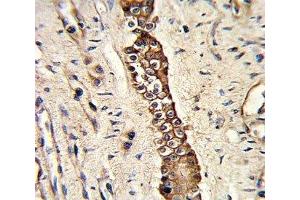 IHC analysis of FFPE human normal lung with DDR2 antibody (DDR2 抗体)