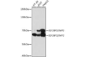 Western blot analysis of extracts of various cell lines, using IGF2BP2/IGF2BP2/IMP2 Rabbit mAb (ABIN7267903) at 1:1000 dilution. (IGF2BP2 抗体)
