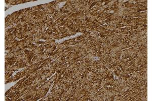 ABIN6268928 at 1/100 staining Rat heart tissue by IHC-P. (Caspase 6 抗体  (Cleaved-Asp179))
