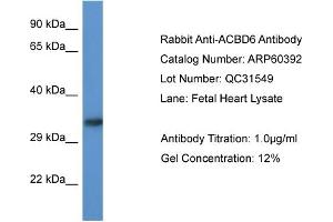 Western Blotting (WB) image for anti-Acyl-CoA Binding Domain Containing 6 (ACBD6) (Middle Region) antibody (ABIN2788432) (ACBD6 抗体  (Middle Region))