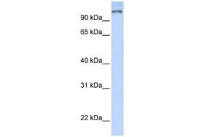 PARP9 antibody used at 1 ug/ml to detect target protein. (PARP9 抗体)